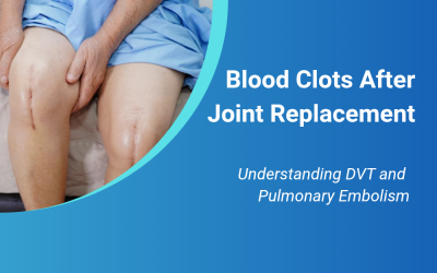 Blood Clots After Joint Replacement: Understanding DVT and Pulmonary Embolism