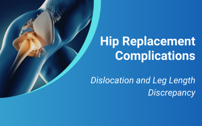 Hip Replacement Complications: Dislocation and Leg Length Discrepancy
