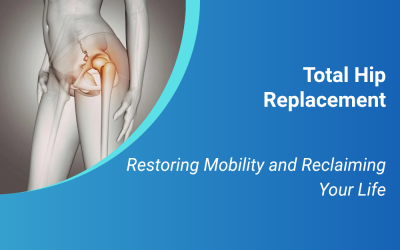 Total Hip Replacement: Restoring Mobility and Reclaiming Your Life