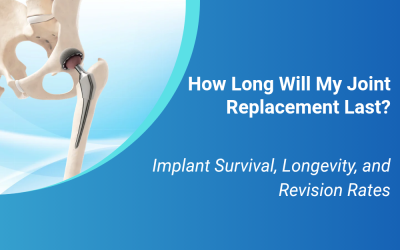 How Long Will My Joint Replacement Last? Implant Survival, Longevity, and Revision Rates