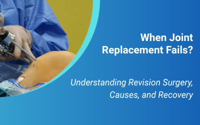 When Joint Replacement Fails: Understanding Revision Surgery, Causes, and Recovery