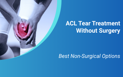 ACL Tear Treatment Without Surgery: Best Non-Surgical Options