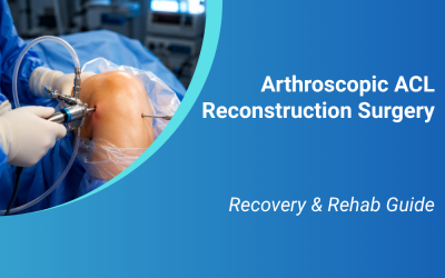 Arthroscopic ACL Reconstruction Surgery: Recovery & Rehab Guide