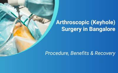Arthroscopic (Keyhole) Surgery in Bangalore: Procedure, Benefits & Recovery
