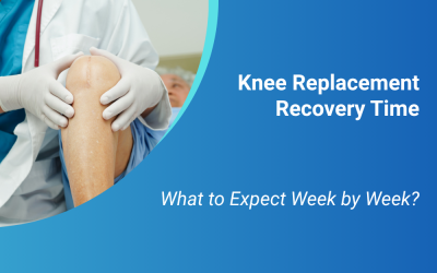 Knee Replacement Recovery Time: What to Expect Week by Week