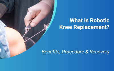 What Is Robotic Knee Replacement? Benefits, Procedure & Recovery