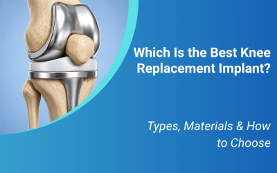 Which Is the Best Knee Replacement Implant? Types, Materials & How to Choose
