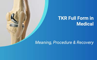 TKR Full Form in Medical: Meaning, Procedure & Recovery